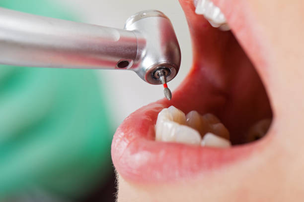 Best Emergency Treatment for Toothache in Rock Port, MO